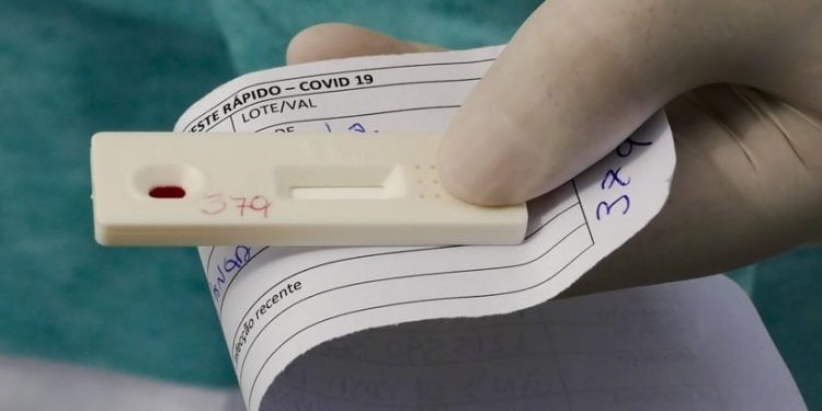 Sooretama realiza testes rápidos de Covid em trabalhadores do comércio