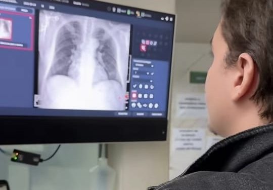 PA de Sooretama passa a oferecer exames de Raio X 24 horas